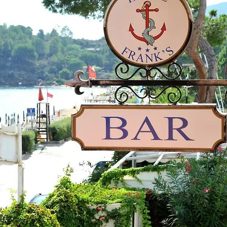 Frank's קאפוליברי